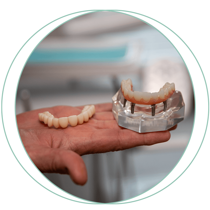 real full arch model