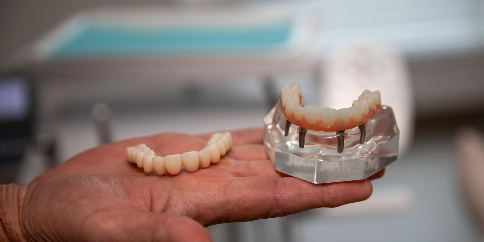 implant model real