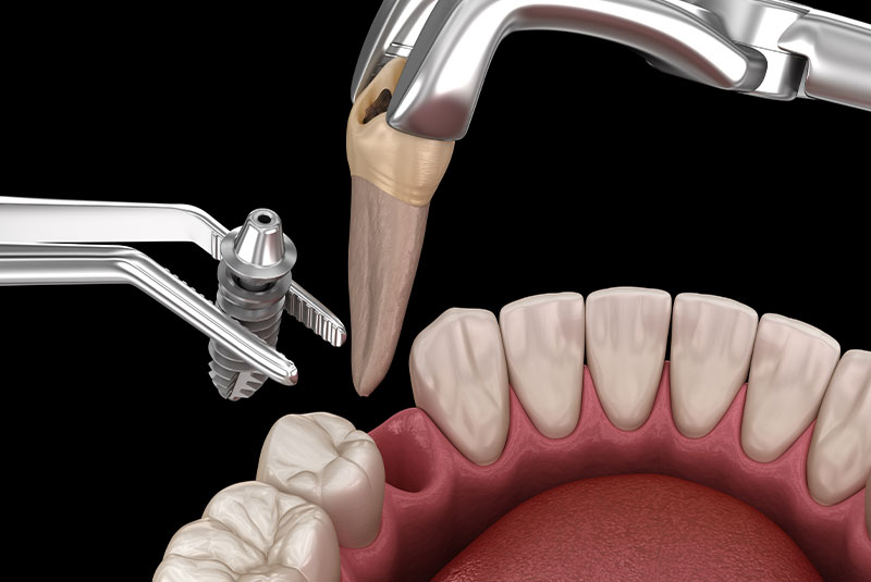 Oral Surgery Services